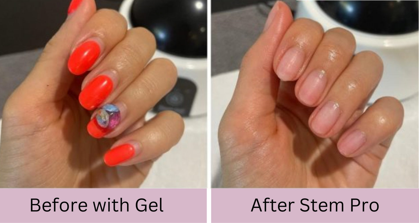 The Steam Care Nail Gel remover™ from Glowkitti