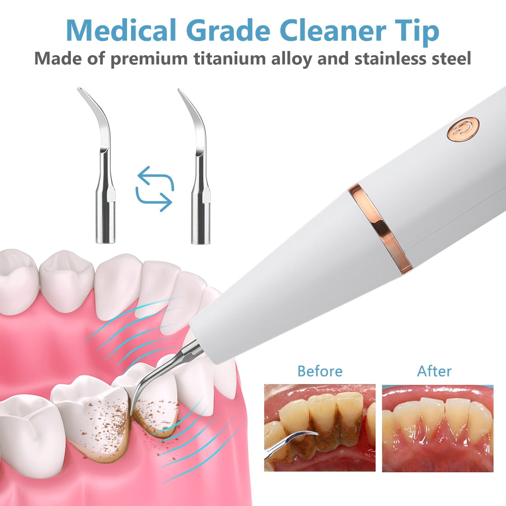 SmilePro2™ Ultrasonic Dental Scaler