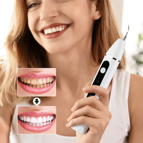 SmilePro™ Ultrasonic Dental Scaler