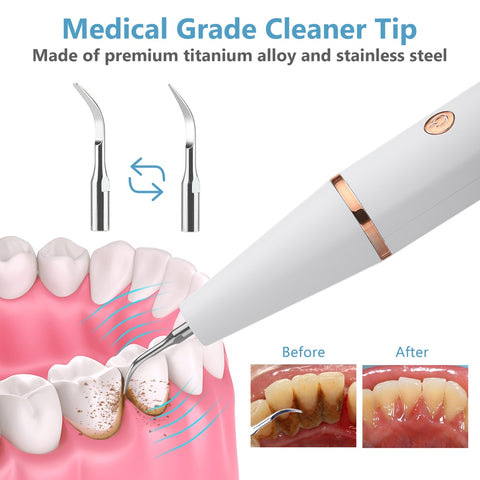 SmilePro™ Ultrasonic Dental Scaler