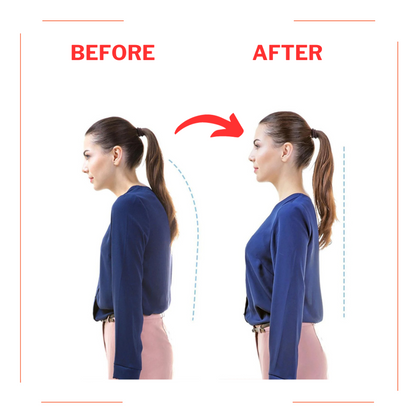 Smart Posture Corrector